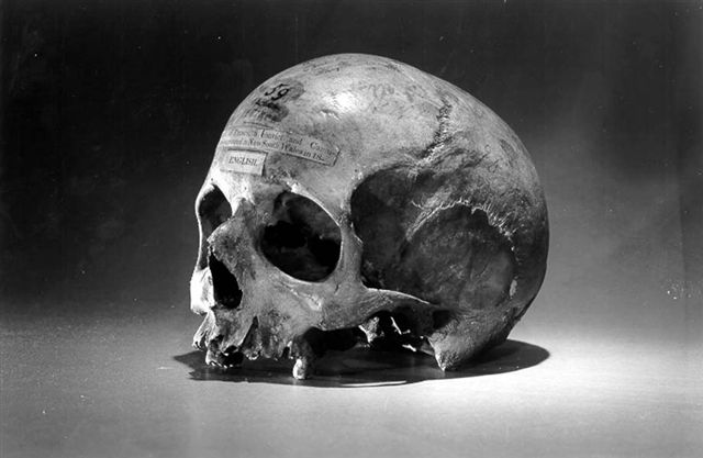 skull_of_alexander_pearce